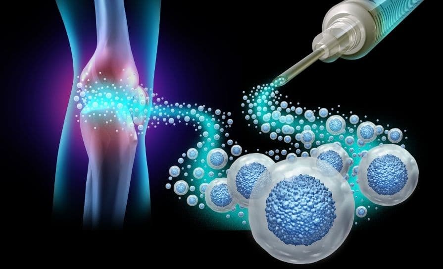 Stem Cell Therapy vs PRP: Which Is Right for You?
