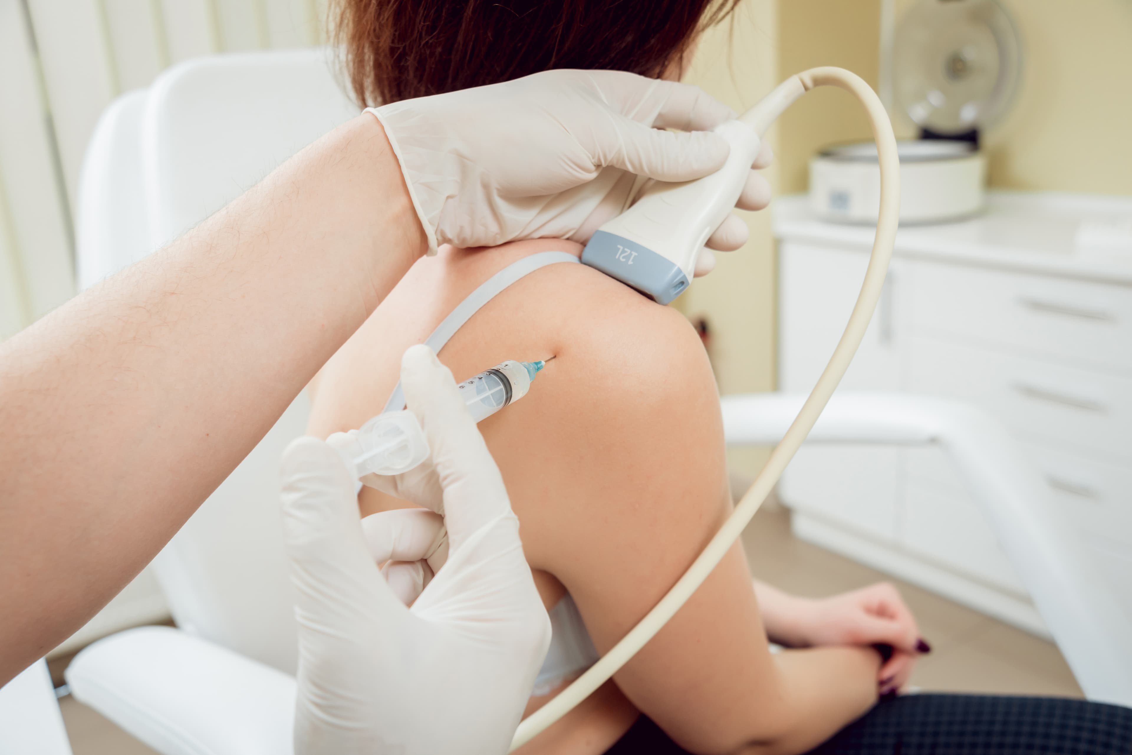 Ultrasound-guided regenerative injection at the shoulder