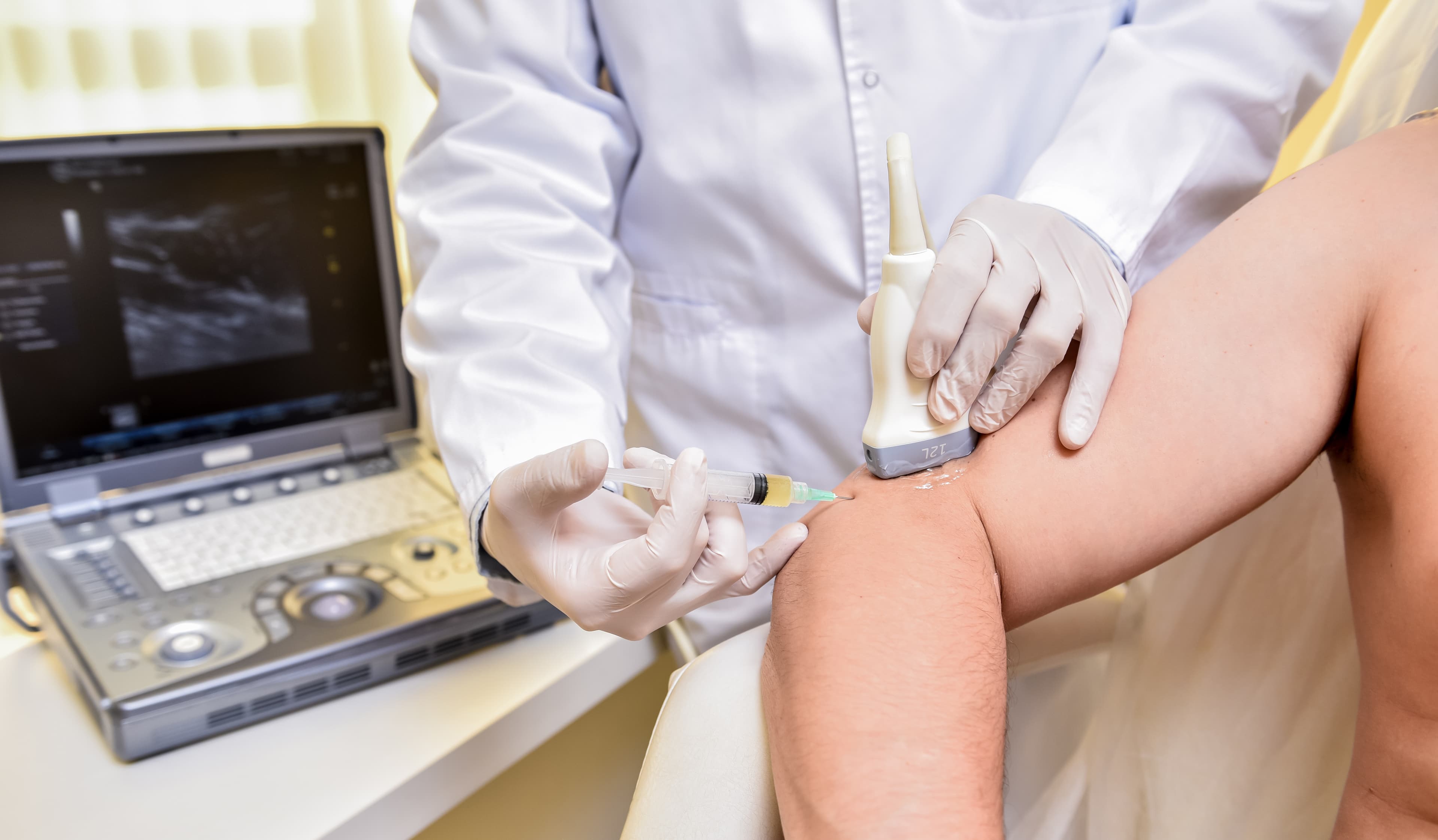 Ultrasound-guided platelet-rich plasma injection at the knee